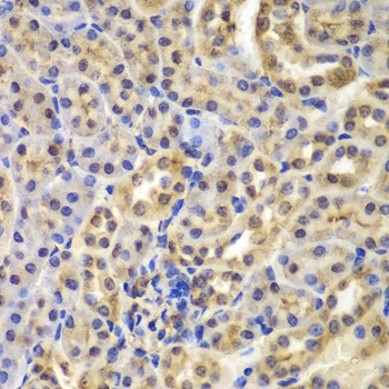 IKB alpha Antibody