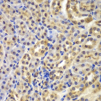 NFKBIA Antibody