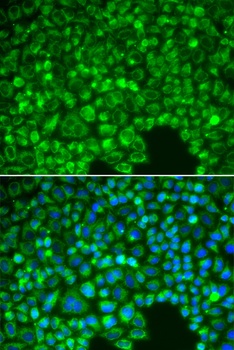 IKB alpha Antibody