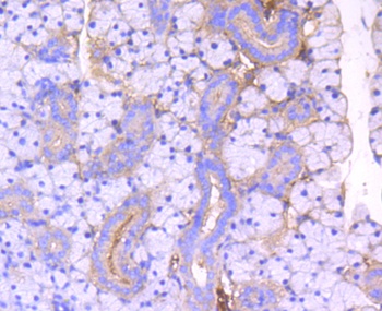 ROCK1 Antibody