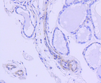 ROCK1 Antibody
