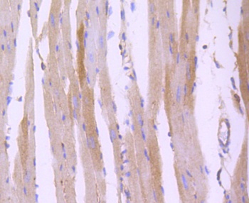 ROCK1 Antibody