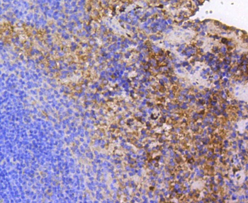 FAK Antibody [E1E5]