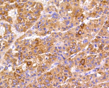 FAK Antibody [E1E5]