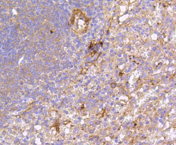 PTK2 Antibody