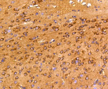 FAK Antibody [E1E5]