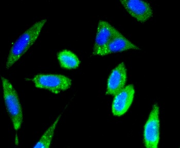 FAK Antibody [E1E5]