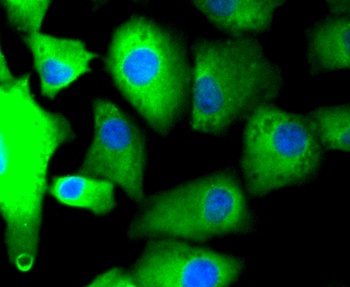 FAK Antibody [E1E5]