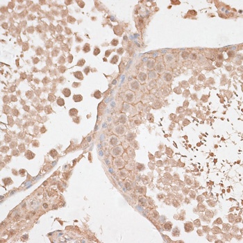 KDR Antibody