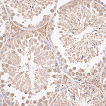 KDR Antibody