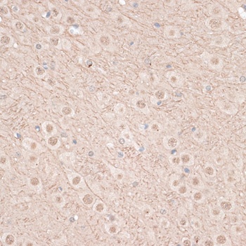 KDR Antibody
