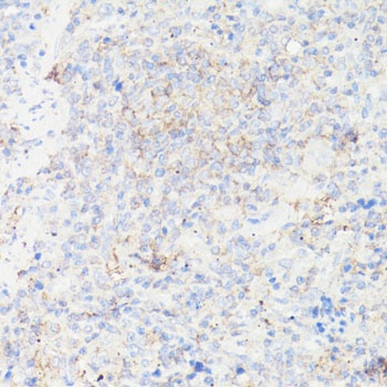 IGFBP1 Antibody
