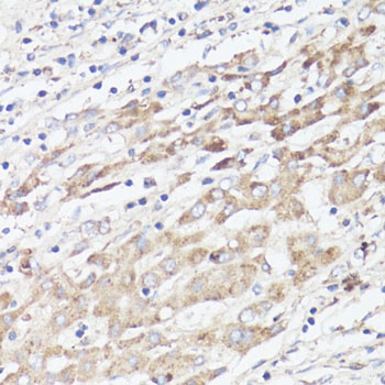 IGFBP1 Antibody