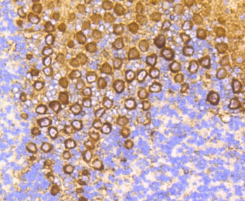 PRKCA Antibody [45F9]