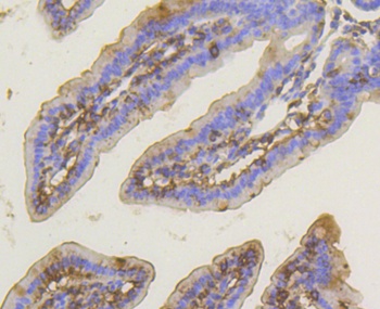 PRKCA Antibody [45F9]