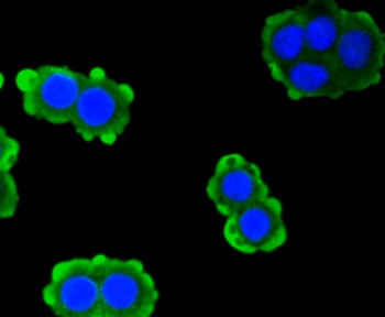 PRKCA Antibody [45F9]