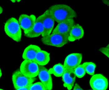 PRKCA Antibody [45F9]