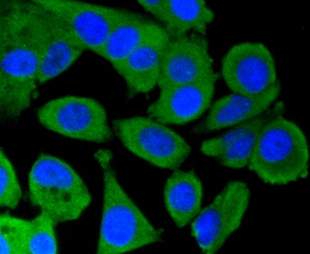 PRKCA Antibody [45F9]