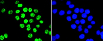 EZH2 Antibody