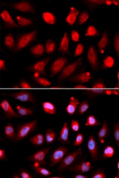 EZH2 Antibody