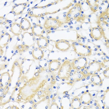 CTGF Antibody