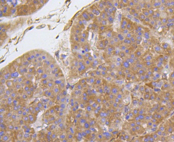 CTGF Antibody