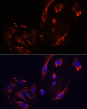 CTGF Antibody