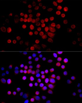 CTGF Antibody