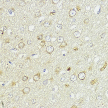 BCL2 Antibody