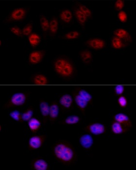 CCND1 Antibody