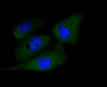 Active Caspase-3 Antibody [H9E5]