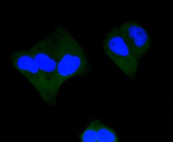 Active Caspase-3 Antibody [H9E5]