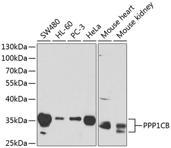 PPP1CB Antibody