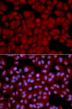 PPP1CB Antibody
