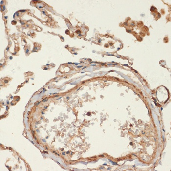 MYH11 Antibody