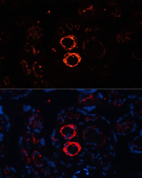 MYH11 Antibody