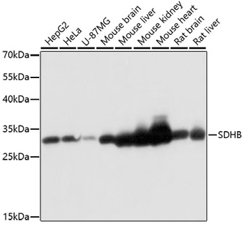 SDHB Antibody