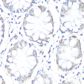 SDHB Antibody