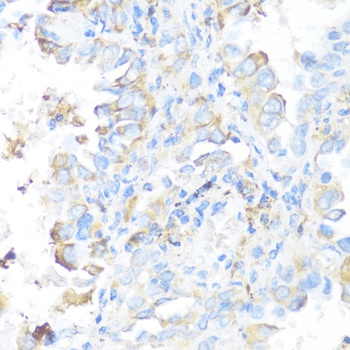 SDHB Antibody