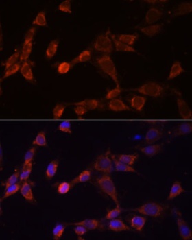PSMD14 Antibody