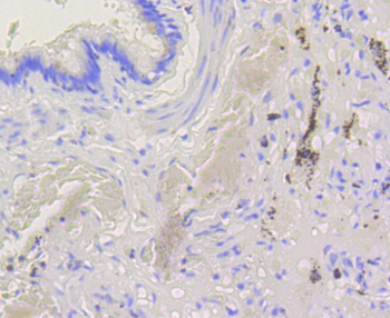 BAK1 Antibody [48A10]