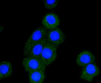 BAK1 Antibody