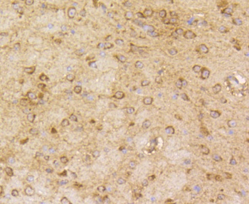 ARRB1 Antibody