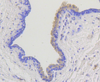 ARRB1 Antibody [F7C2]