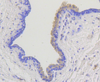 ARRB1 Antibody