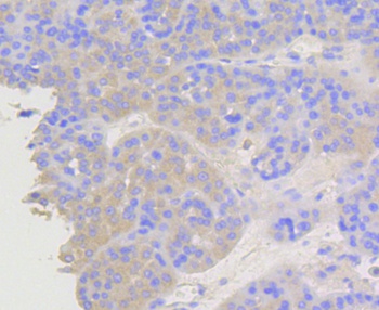 ARRB1 Antibody [F7C2]