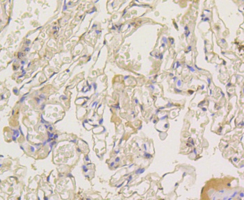 ARRB1 Antibody