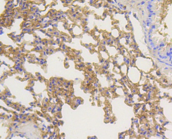 ARRB1 Antibody