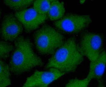ARRB1 Antibody [F7C2]