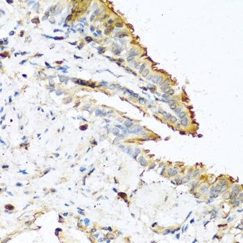 RNASE13 Antibody